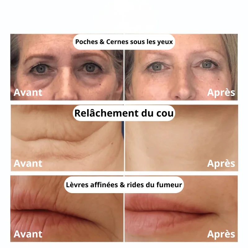 Cure anti-âge au collagène