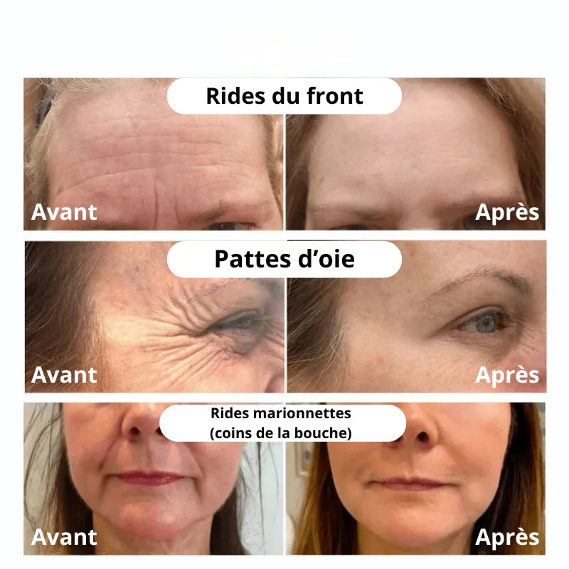 Cure anti-âge au collagène